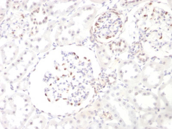 Wilm's Tumor 1 (WT1) (Wilm's Tumor & Mesothelial Marker) Antibody - With BSA and Azide