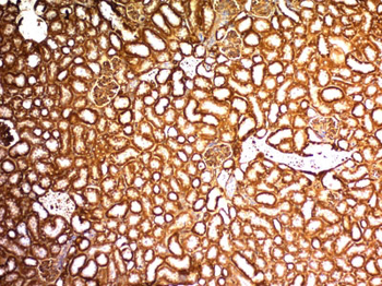 Wilm's Tumor 1 (WT1) (Wilm's Tumor & Mesothelial Marker) Antibody - With BSA and Azide