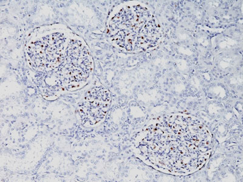 Wilm's Tumor 1 (WT1) (Wilm's Tumor & Mesothelial Marker) Antibody - With BSA and Azide