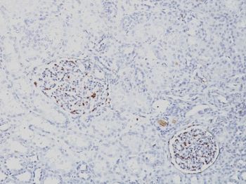 Wilm's Tumor 1 (WT1) (Wilm's Tumor & Mesothelial Marker) Antibody - With BSA and Azide