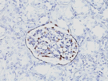Wilm's Tumor 1 (WT1) (Wilm's Tumor & Mesothelial Marker) Antibody - With BSA and Azide