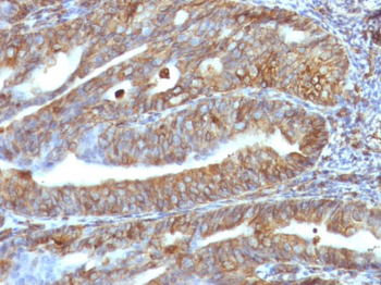 Vimentin (Mesenchymal Cell Marker) Antibody - With BSA and Azide