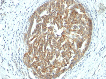 VEGF (Vascular Endothelial Growth Factor) Antibody - With BSA and Azide