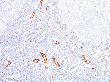VEGF (Vascular Endothelial Growth Factor) Antibody - With BSA and Azide