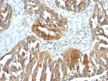 VEGF (Vascular Endothelial Growth Factor) Antibody - With BSA and Azide