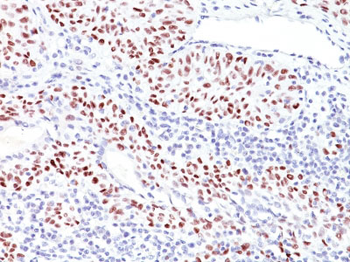 p53 Tumor Suppressor Protein Antibody - With BSA and Azide