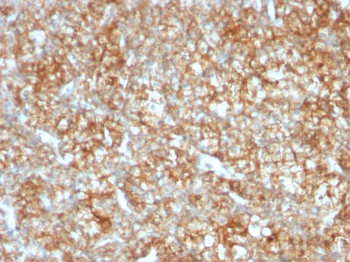 CD147 / EMMPRIN / Neurothelin Antibody - With BSA and Azide