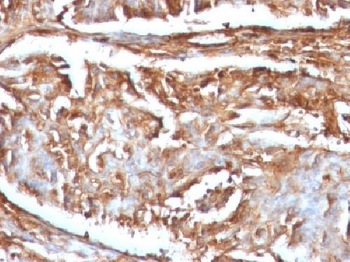 Beta-2 Microglobulin (Renal Failure & Tumor Marker) Antibody - With BSA and Azide