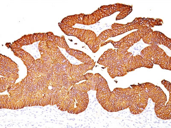 Ep-CAM / CD326 (Epithelial Marker) Antibody - With BSA and Azide