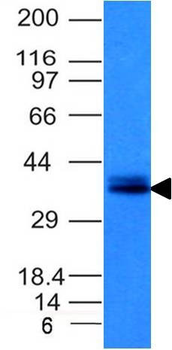 Ep-CAM / CD326 (Epithelial Marker) Antibody - With BSA and Azide