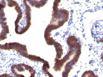 Ep-CAM / CD326 (Epithelial Marker) Antibody - With BSA and Azide