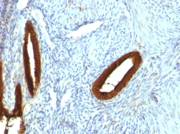 Cytokeratin 19 (KRT19) (Pancreatic Stem Cell Marker) Antibody - With BSA and Azide