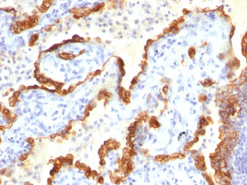 Cytokeratin 18 (KRT18) Antibody - With BSA and Azide