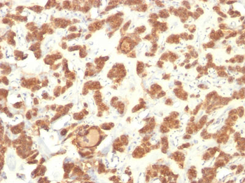 Cytokeratin 18 (KRT18) Antibody - With BSA and Azide