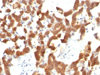 Cytokeratin 18 (KRT18) Antibody - With BSA and Azide