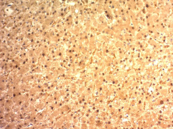 Arginase 1 (Hepatocellular Carcinoma Marker) Antibody - With BSA and Azide