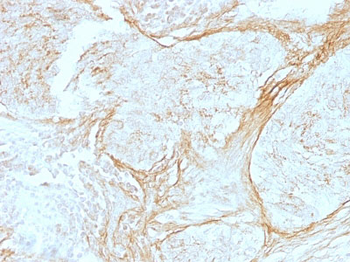 Tenascin C (Stromal Marker For Epithelial Malignancy) Antibody - With BSA and Azide