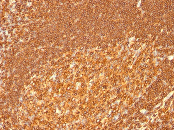 HLA-DRB (MHC II) Antibody - With BSA and Azide