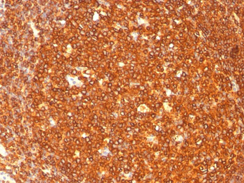 HLA-DRB (MHC II) Antibody - With BSA and Azide
