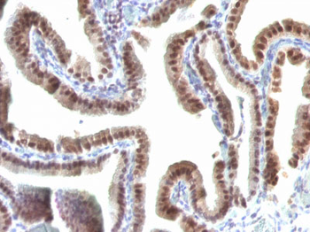 TOX3 / TNRC9 Antibody - With BSA and Azide