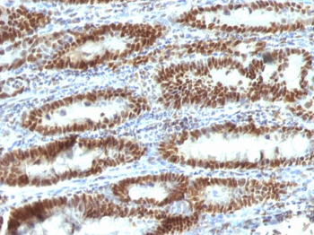 TOX3 / TNRC9 Antibody - With BSA and Azide
