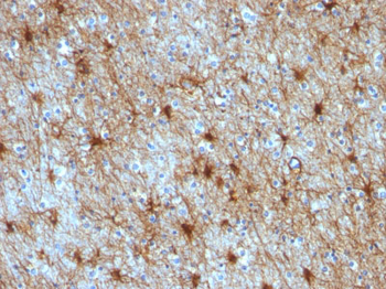 GFAP (Astrocyte & Neural Stem Cell Marker) Antibody - With BSA and Azide