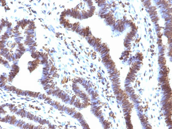 EMI1 (Early Mitotic Inhibitor-1) Antibody - With BSA and Azide