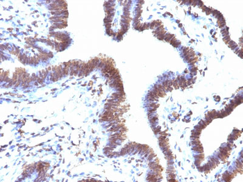 EMI1 (Early Mitotic Inhibitor-1) Antibody - With BSA and Azide
