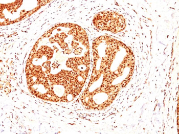 ER-beta1 (Estrogen Receptor beta-1) Antibody - With BSA and Azide