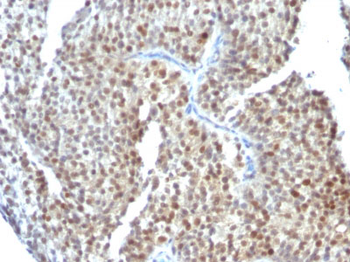 ER-beta1 (Estrogen Receptor beta-1) Antibody - With BSA and Azide