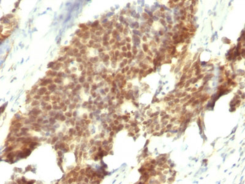 ER-beta1 (Estrogen Receptor beta-1) Antibody - With BSA and Azide