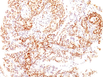 ER-beta1 (Estrogen Receptor beta-1) Antibody - With BSA and Azide
