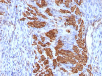 Calponin-1 (Smooth Muscle Marker) Antibody - With BSA and Azide