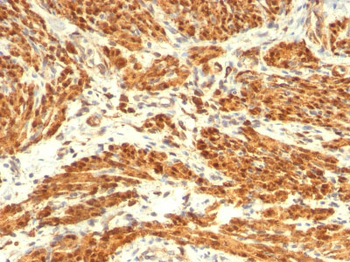 Calponin-1 (Smooth Muscle Marker) Antibody - With BSA and Azide