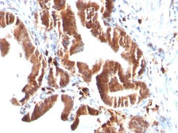 Topoisomerase (DNA) I, Mitochondrial (TOP1MT) Antibody - With BSA and Azide