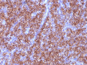 Chromogranin A / CHGA (Neuroendocrine Marker) Antibody - With BSA and Azide