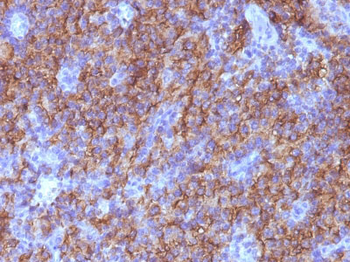 Chromogranin A / CHGA (Neuroendocrine Marker) Antibody - With BSA and Azide
