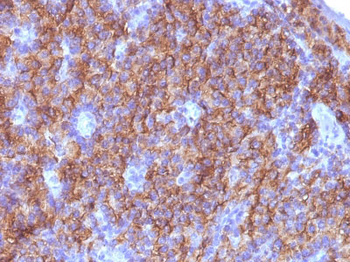 Chromogranin A / CHGA (Neuroendocrine Marker) Antibody - With BSA and Azide