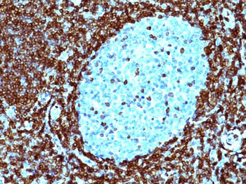 Bcl-2 (Apoptosis & Follicular Lymphoma Marker) Antibody - With BSA and Azide