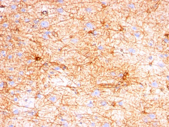 GFAP (Astrocyte & Neural Stem Cell Marker) Antibody - With BSA and Azide