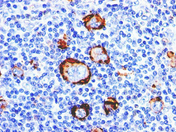 CD15 / FUT4 (Reed-Sternberg Cell Marker) Antibody - With BSA and Azide