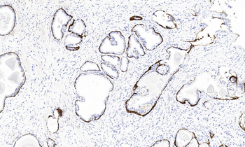 CD44v6 Antibody