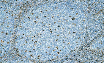 AACT Antibody