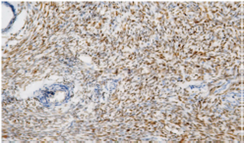 FAP Antibody