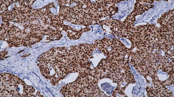 FOX A1 Antibody