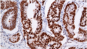 PMS2 Antibody