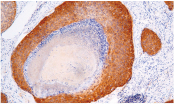 CDKN2A Antibody
