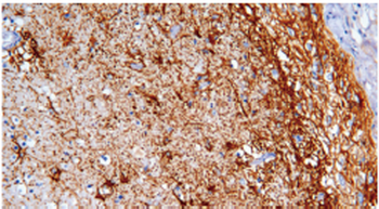 NES Antibody