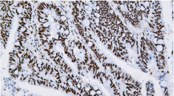 MSH2 Antibody