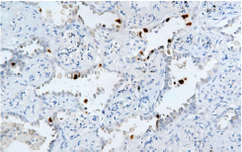 MDM2 Antibody